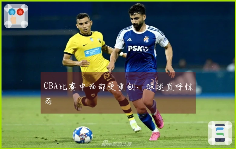 CBA比赛中面部受重创，球迷直呼惊恐